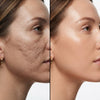 Dr Pen M7 Professional Microneedling Pen